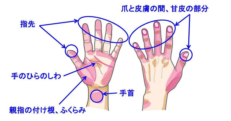 洗い残しの多い部分